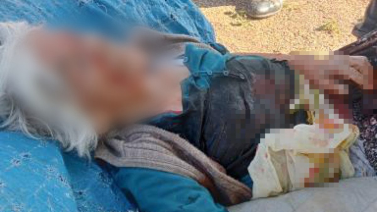 Niğde’de başıboş köpeklerin saldırdığı kadın ağır yaralandı